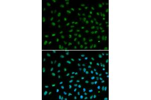 Immunofluorescence analysis of MCF-7 cells using DDB2 antibody (ABIN5970947). (DDB2 anticorps)