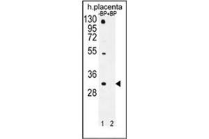 Western blot analysis of OR1D5 Antibody (C-term) Cat. (OR1D5 anticorps  (C-Term))