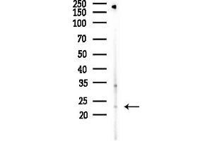 anti-Ribosomal Protein S9 (RPS9) (Internal Region) antibody