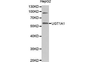 Western Blotting (WB) image for anti-UDP Glucuronosyltransferase 1 Family, Polypeptide A1 (UGT1A1) (AA 1-200) antibody (ABIN1683210) (UGT1A1 anticorps  (AA 1-200))