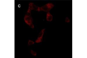 Detection of cathepsin B (CB) activity in Eca-109 cells by the CB probe. (Chèvre anti-Lapin IgG Anticorps (FITC))