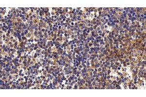Detection of FAS in Porcine Lymph node Tissue using Polyclonal Antibody to Factor Related Apoptosis (FAS)