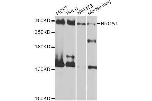 Western blot analysis of extracts of various cell lines, using BRCA1 antibody (ABIN5997316) at 1/1000 dilution.