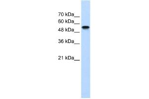 WB Suggested Anti-NR1H2 Antibody Titration:  1. (NR1H2 anticorps  (N-Term))