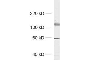 dilution: 1 : 1000, sample: synaptic membrane fraction (LP1) (Kv2.2 anticorps  (AA 859-873))