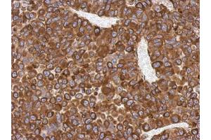 IHC-P Image Immunohistochemical analysis of paraffin-embedded PC13 xenograft, using AGR3, antibody at 1:500 dilution. (AGR3 anticorps  (Center))