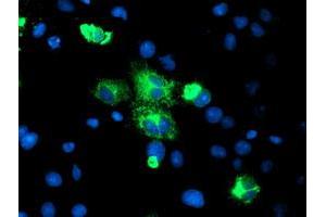 Image no. 4 for anti-Carboxypeptidase A2 (Pancreatic) (CPA2) antibody (ABIN1497595)
