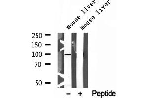 Western blot analysis of extracts of mouse liver tissue, using AGGF1 antibody. (AGGF1 anticorps  (Internal Region))