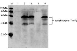 Western blot analysis of mouse brain tissue lysate using Rabbit Anti-Tau (Phospho-Thr217) Polyclonal Antibody (ABIN398308) Lane 1: Primary antibody negative controlLane 2: Rabbit Anti-Tau (Phospho-Thr217) Polyclonal AntibodyLane 3: Rabbit Anti-Tau (Phospho-Thr217) Polyclonal Antibody pre-incubated with non-phoshpo-peptideLane 4: Rabbit Anti-Tau (Phospho-Thr217) Polyclonal Antibody pre-incubated with phoshpo-peptideLane 5: Rabbit Anti-Tau (Phospho-Thr217) Polyclonal Antibody pre-incubated with generic phospho-threonine containing peptideSecondary antibody: Goat Anti-Rabbit IgG (H&L) [HRP] Polyclonal Antibody (ABIN398323) The signal was developed with LumiSensorTM HRP Substrate Kit (ABIN769939) (tau anticorps  (pThr217))