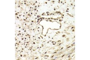 Immunohistochemistry of paraffin-embedded human leiomyoma of uterus using FKBP4 Antibody.