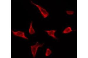 ABIN6276165 staining Hela by IF/ICC.