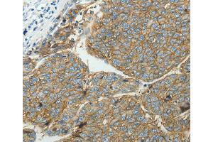 Immunohistochemistry (IHC) image for anti-Solute Carrier Family 16, Member 1 (Monocarboxylic Acid Transporter 1) (SLC16A1) antibody (ABIN2431637)