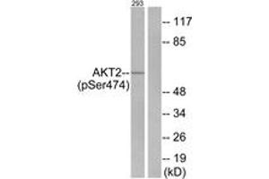 Western blot analysis of extracts from 293 cells treated with EGF 200ng/ml 30', using Akt2 (Phospho-Ser474) Antibody. (AKT2 anticorps  (pSer474))