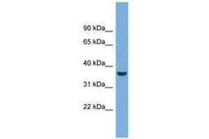 Image no. 1 for anti-Crystallin, mu (CRYM) (AA 71-120) antibody (ABIN6743607)
