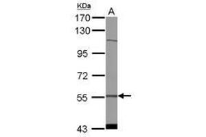 Image no. 1 for anti-Cytidine and DCMP Deaminase Domain Containing 1 (CDADC1) (AA 279-501) antibody (ABIN1497387) (CDADC1 anticorps  (AA 279-501))