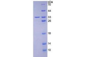 SDS-PAGE analysis of Human HABP1 Protein. (C1QBP Protéine)