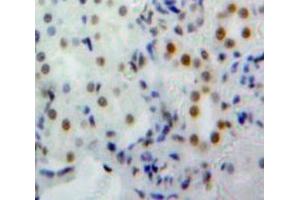 Used in DAB staining on fromalin fixed paraffin-embedded Kidney tissue (NUP160 anticorps  (AA 11-206))