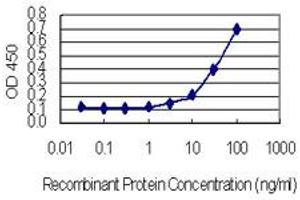 Detection limit for recombinant GST tagged HARS is 0.