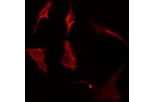 ABIN6275088 staining  Hela cells by IF/ICC. (MARCH3 anticorps  (Internal Region))