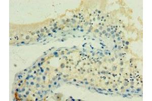 Immunohistochemistry of paraffin-embedded human testis tissue using ABIN7154927 at dilution of 1:100 (HSPA2 anticorps  (AA 400-639))