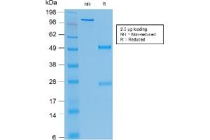 SDS-PAGE Analysis Purified CEA Mouse Recombinant Monoclonal Antibody (rC66/1009). (Recombinant CEACAM5 anticorps)