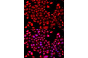 Immunofluorescence analysis of A549 cell using RARG antibody. (Retinoic Acid Receptor gamma anticorps)