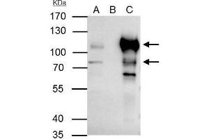 IP Image BCL6 antibody immunoprecipitates BCL6 protein in IP experiments.
