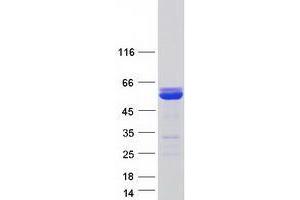 Validation with Western Blot (XRCC4 Protein (Transcript Variant 1) (Myc-DYKDDDDK Tag))