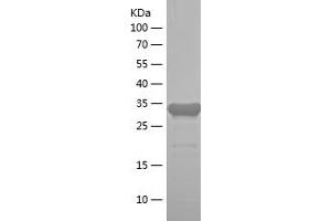 Western Blotting (WB) image for Pyrroline-5-Carboxylate Reductase Family, Member 2 (PYCR2) (AA 263-320) protein (His-IF2DI Tag) (ABIN7124719)