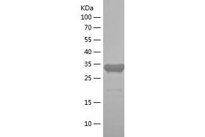 Western Blotting (WB) image for Pyrroline-5-Carboxylate Reductase Family, Member 2 (PYCR2) (AA 263-320) protein (His-IF2DI Tag) (ABIN7124719)