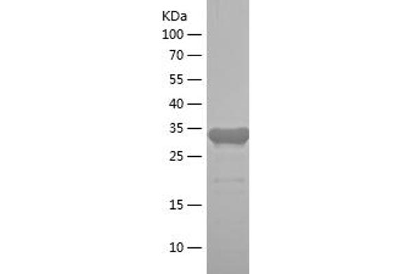 PYCR2 Protein (AA 263-320) (His-IF2DI Tag)
