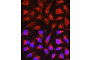 Immunofluorescence analysis of HeLa cells using PYGL Rabbit pAb (ABIN6132277, ABIN6146525, ABIN6146526 and ABIN6222425) at dilution of 1:150 (40x lens).