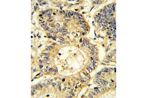 Immunohistochemistry (IHC) image for anti-Suppressor of Cytokine Signaling 1 (SOCS1) antibody (ABIN3003913)