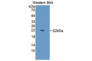 Western blot analysis of the recombinant protein. (SERPING1 anticorps  (AA 148-270))