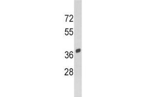 Western blot analysis of SPARC antibody and Y79 lysate.