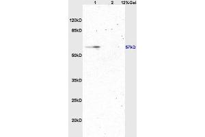 Lane 1: rat brain lysates Lane 2: rat kidney lysates probed with Anti ATG13 Polyclonal Antibody, Unconjugated (ABIN750313) at 1:200 in 4 °C. (ATG13 anticorps  (AA 51-150))