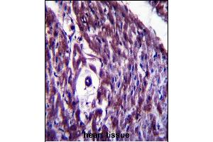 anti-Melanoma Antigen Family D, 4B (MAGED4B) (AA 328-357) antibody