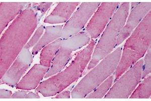 Human Skeletal Muscle: Formalin-Fixed, Paraffin-Embedded (FFPE)