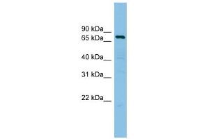 AKAP10 antibody used at 1 ug/ml to detect target protein.