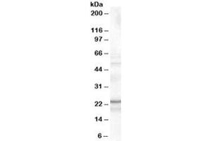 Western blot testing of K562 cell lysate with TIRAP antibody at 0. (TIRAP anticorps)