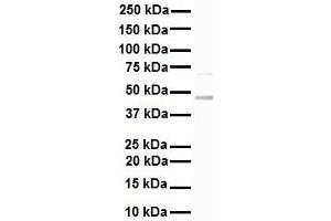 WB Suggested Anti-KRT17 antibody Titration: 1 ug/mL Sample Type: Human Hela