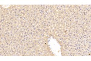 Detection of LDLR in Mouse Liver Tissue using Polyclonal Antibody to Low Density Lipoprotein Receptor (LDLR) (LDLR anticorps  (AA 263-509))