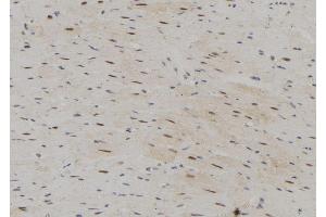 ABIN6273076 at 1/100 staining Rat heart tissue by IHC-P. (SRP68 anticorps  (C-Term))