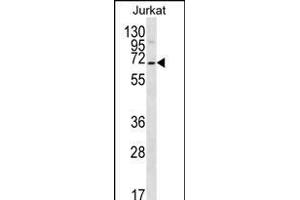 PSL1 Antibody (N-term) 12400a western blot analysis in Jurkat cell line lysates (35 μg/lane). (PSAPL1 anticorps  (N-Term))
