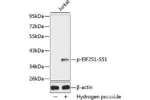 Western blot analysis of extracts from Jurkat cells using Phospho-eIF2α(S51) Polyclonal Antibody. (EIF2A anticorps  (pSer51))
