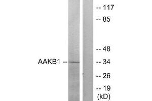 Western Blotting (WB) image for anti-Protein Kinase, AMP-Activated, beta 1 Non-Catalytic Subunit (PRKAB1) (N-Term) antibody (ABIN1850404) (PRKAB1 anticorps  (N-Term))