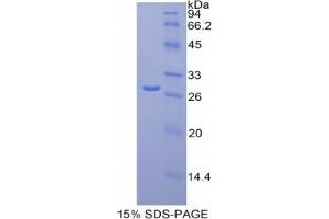 SDS-PAGE analysis of Human MCAM Protein. (MCAM Protéine)