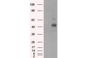 Image no. 2 for anti-Protein Kinase, CAMP-Dependent, Regulatory, Type II, alpha (PRKAR2A) antibody (ABIN1500259)