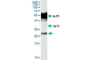 anti-Centromere Protein N (CENPN) (AA 1-204) antibody