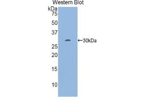 Detection of Recombinant EGR2, Mouse using Polyclonal Antibody to Early Growth Response Protein 2 (EGR2) (EGR2 anticorps  (AA 150-407))
